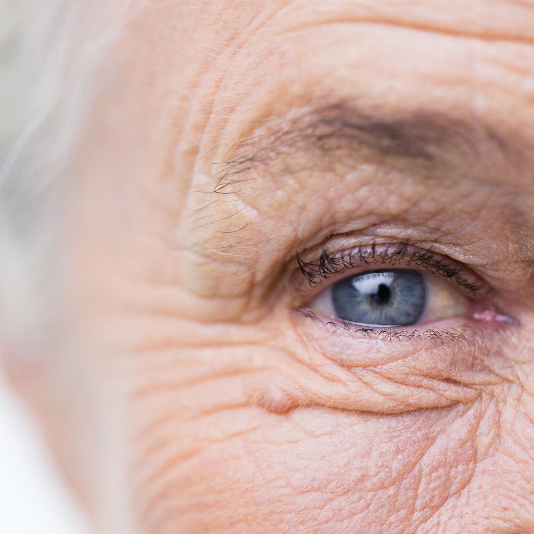 How Aging Affect Your Hair