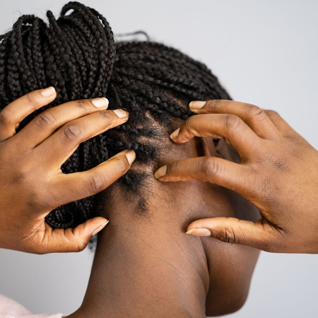 How to Improve Scalp Health Naturally: Beyond Basics for Real Results